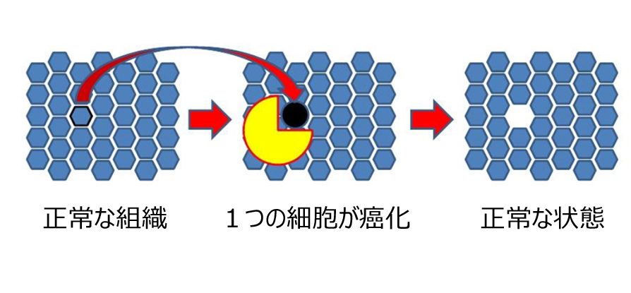 癌が小さいうちは活性化マクロファージが退治