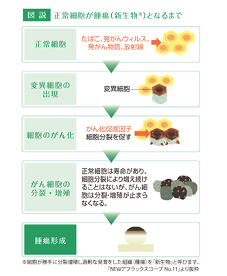 図説：正常細胞が腫瘍（新生物）となるまで