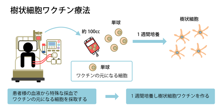 樹状細胞ワクチン療法
